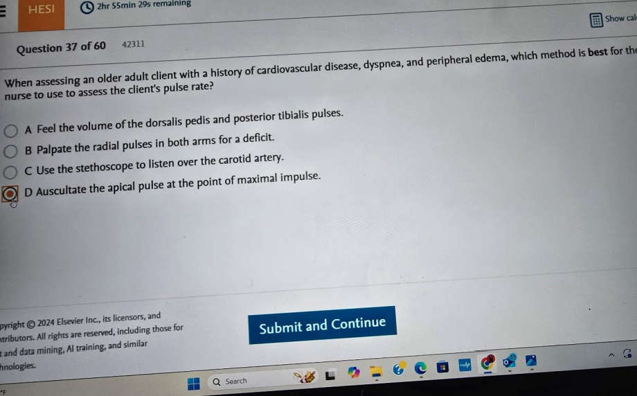 WGU D443 HEALTH ASSESSMENT OA1