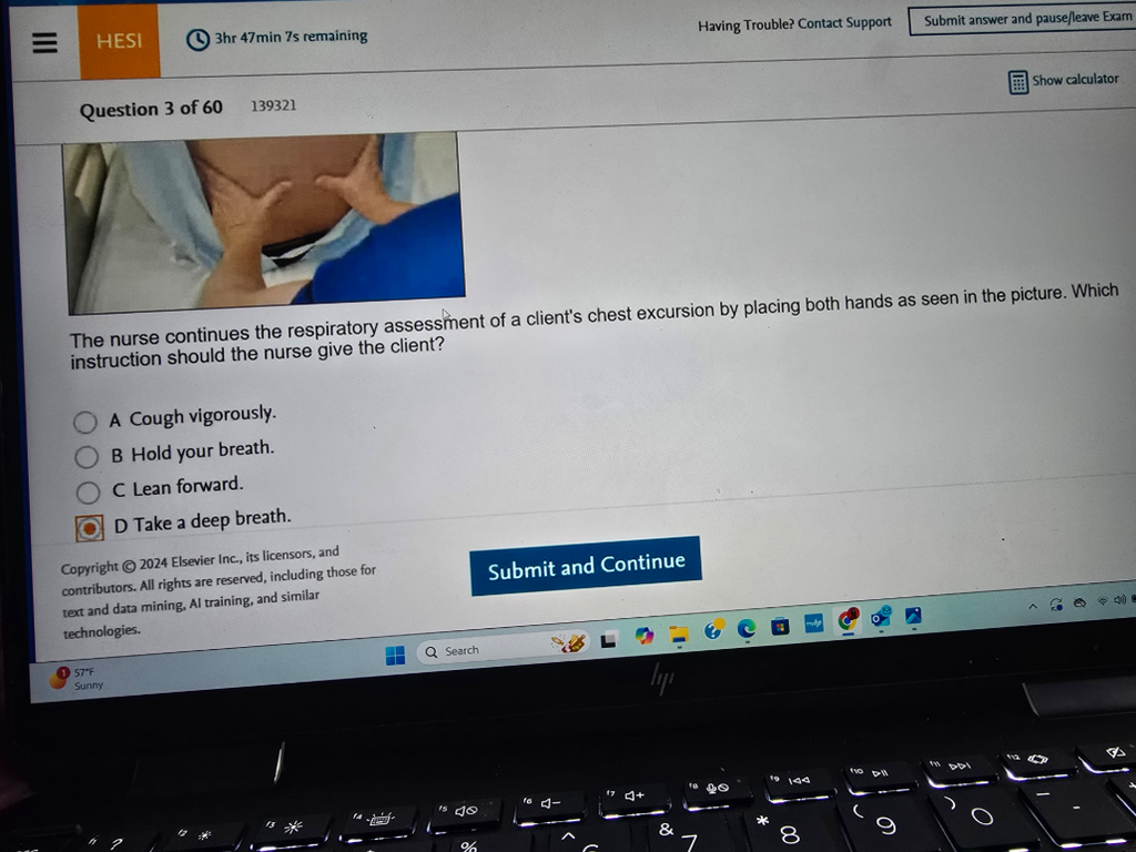 WGU D443 HEALTH ASSESSMENT OA1