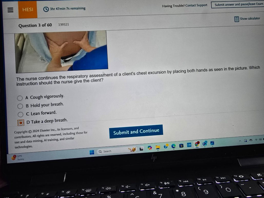 WGU D443 HEALTH ASSESSMENT OA1