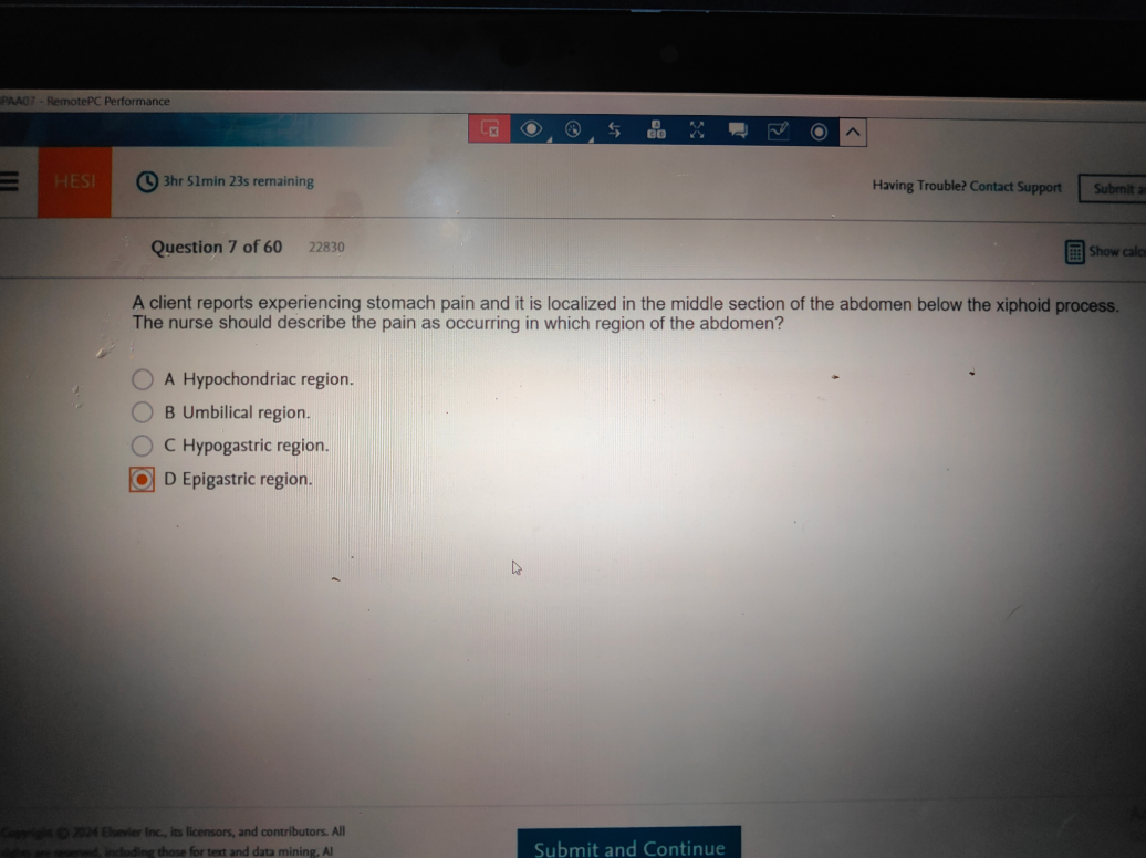WGU D443 HEALTH ASSESSMENT OA2